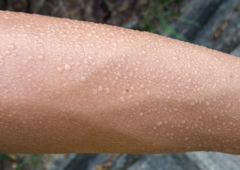 Brazo con sudor