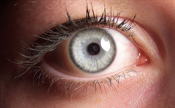 Ojo